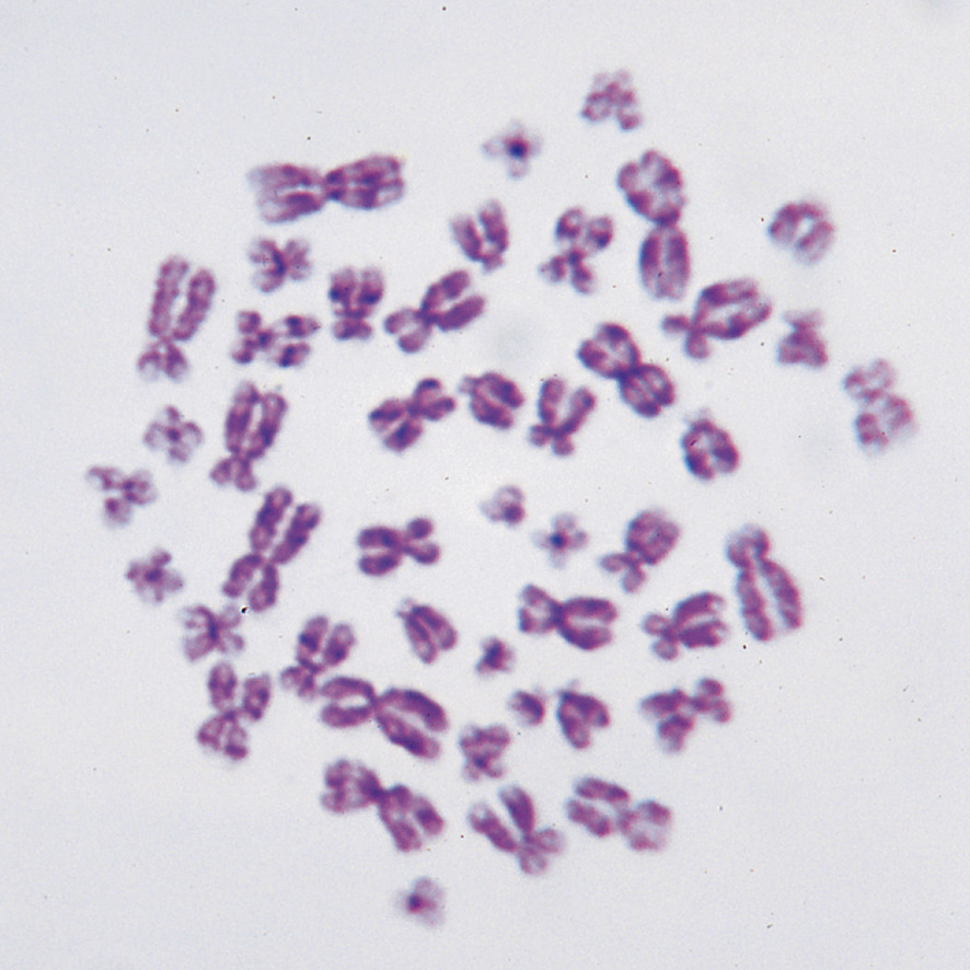 사람염색체(영구프레파라트)-CX6134