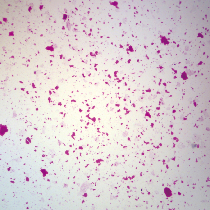 살모넬라균 프레파라트-CX6174
