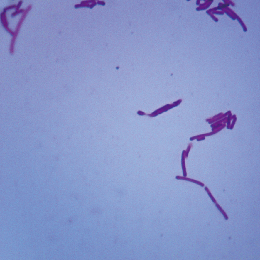 유산균 프레파라트-CX6177